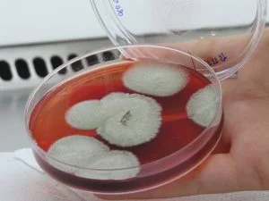 Leia mais sobre o artigo Fungos encontrados no rio Amazonas no combate ao câncer