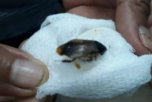 Leia mais sobre o artigo Médico retira barata do ouvido de paciente em Iranduba, no Amazonas