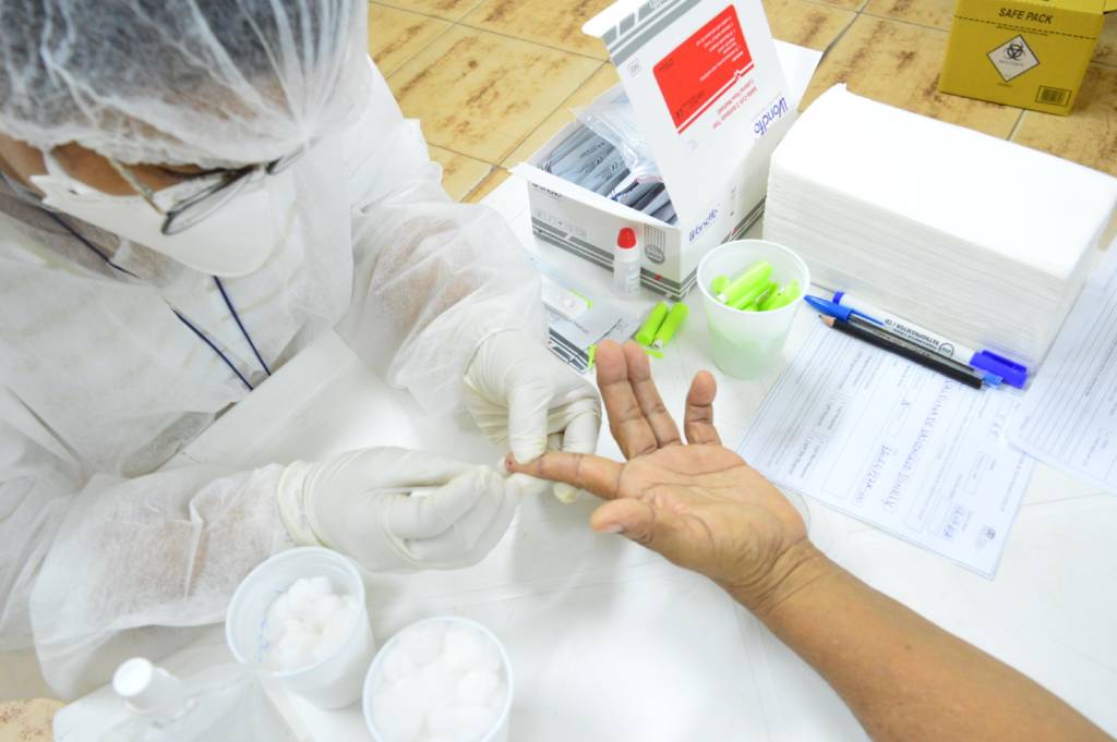 You are currently viewing Policlínica Gilberto Mestrinho retoma serviço de testagem de HIV, sífilis e hepatites
