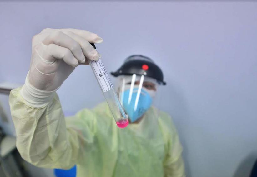 No momento, você está visualizando Amazonas registra 2.740 novos casos de covid-19