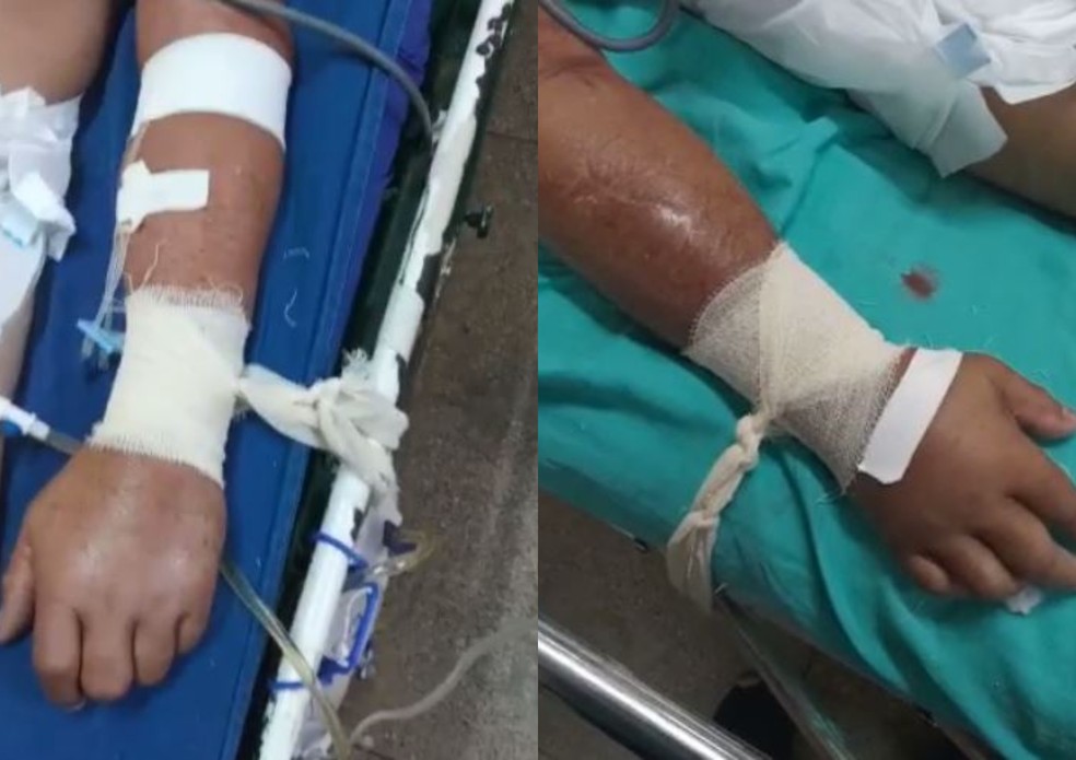 No momento, você está visualizando Defensoria investiga se pacientes com Covid foram amarrados por falta de sedativo no interior do AM