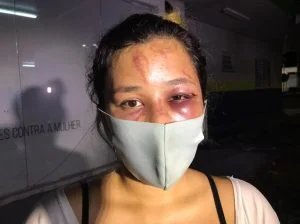 Leia mais sobre o artigo Promotora de vendas denuncia que foi tirada do trabalho e agredida na rua por ex-namorado em Manaus