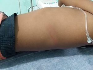 Read more about the article Menino de 8 anos é espancado pelo padrasto ao defender a mãe no Amazonas