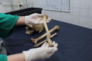 Read more about the article Peritos do Amazonas usam antropologia forense para identificar ossadas humanas