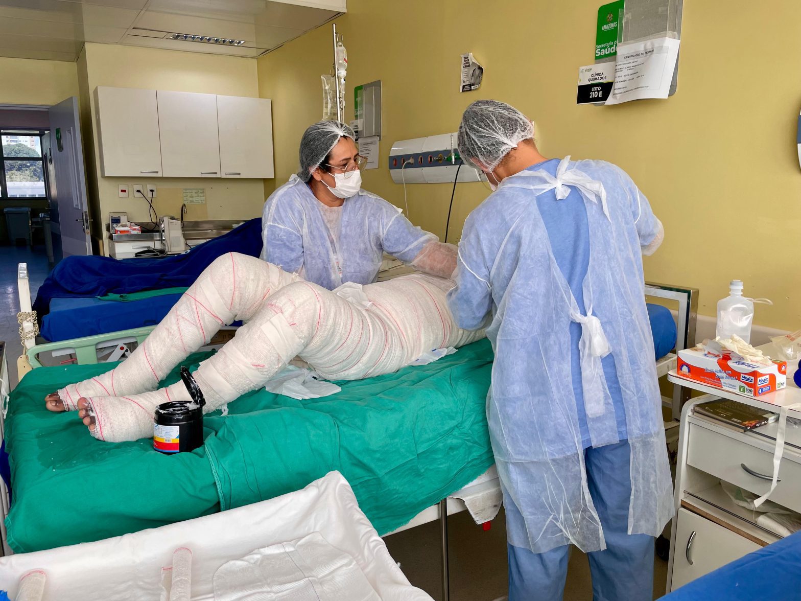 No momento, você está visualizando Referência para o SUS, Centro de Tratamento de Queimados do HPS 28 de Agosto ganha importância estratégica na região