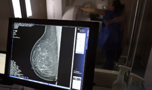 Leia mais sobre o artigo Falta de acesso a mamógrafos limita prevenção do câncer de mama